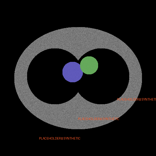 Segmentation overlay