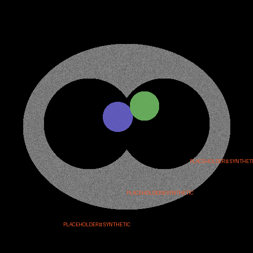 Segmentation overlay